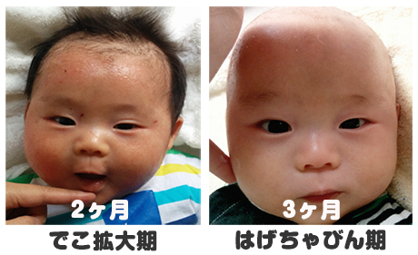 赤ちゃん　2ヶ月　3ヶ月　成長　顔　変わる